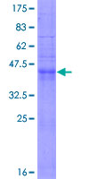 12.5% SDS-PAGE Stained with Coomassie Blue.